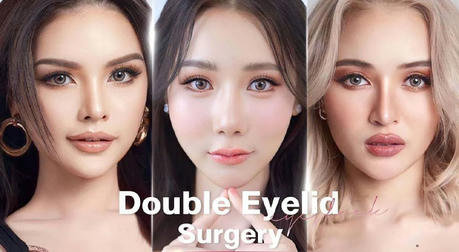  The Key to Unlocking Youthful Eyes: Discover the Transformative Power of Eyelid Surgery!